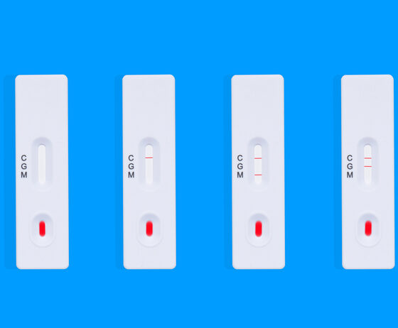 Understanding Rapid Tests: Quick and Convenient Medical Tools